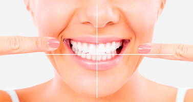 Estética-dental-odontologica-suiza-trujillo-peru